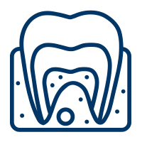 Endodontics (Root Canal Treatment)